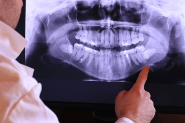 Best Dental Abscess Treatment in Hermitage, PA